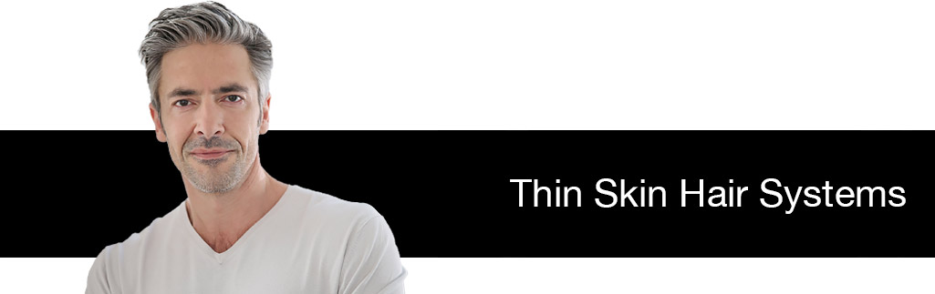 Thin Skin Hair Systems